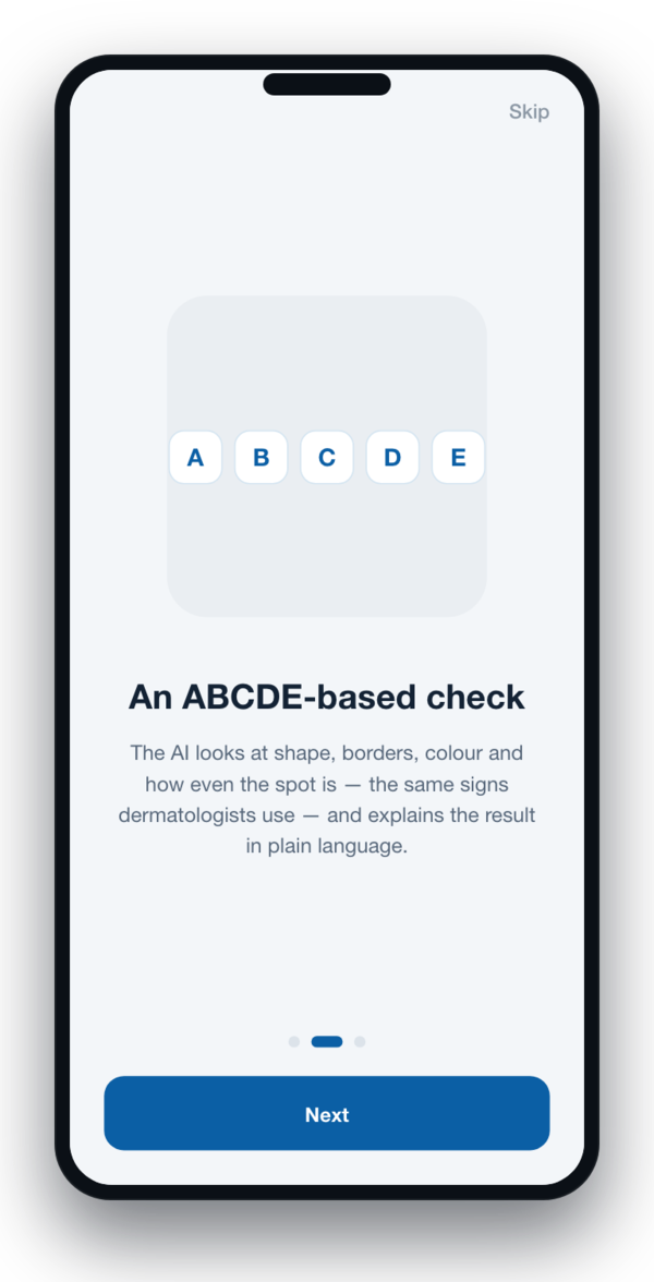 ABCDE-based check explanation