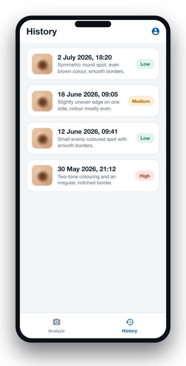 History of saved mole checks